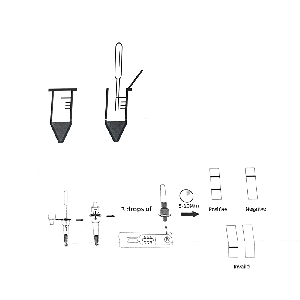1set/5set profession elles Hau – Urine Analyzer Strip Bewertung und Preis